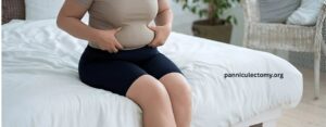 Panniculectomy Covered By Insurance